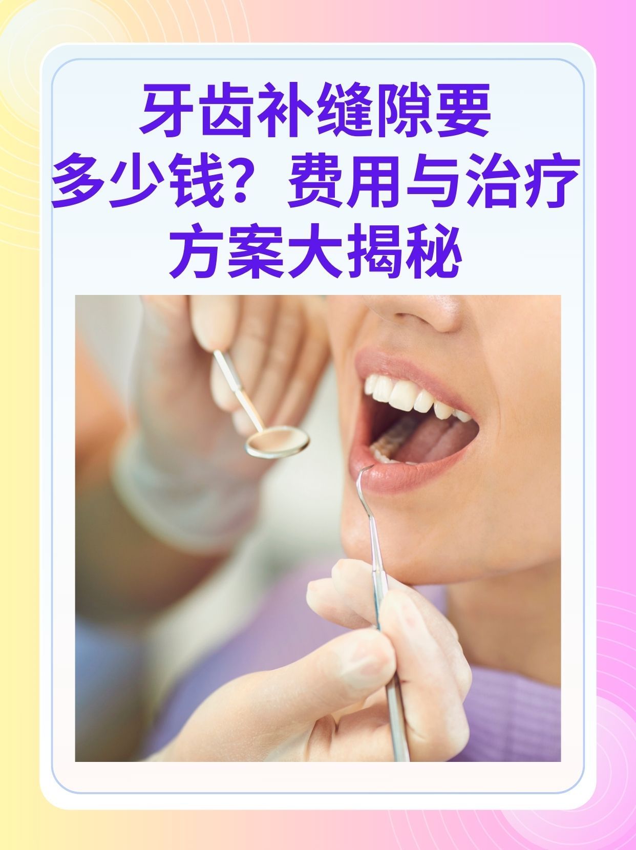 安阳补牙医保可以报销吗(补牙医保可以报销吗 哪些可以报销呢)